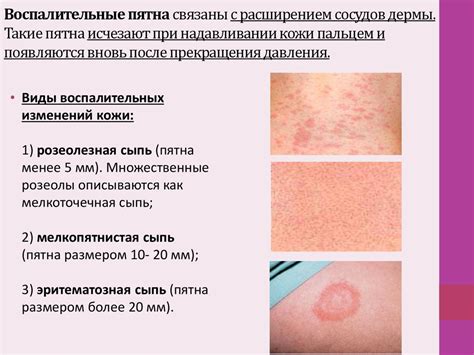 Характерные проявления высыпаний на коже