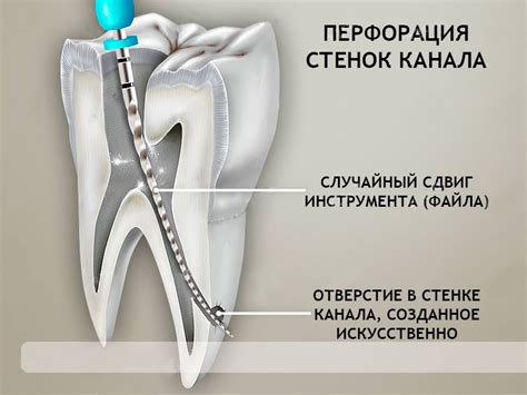 Цены и услуги салонов ушной перфорации в Евпатории