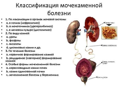  Влияние диеты на состояние при наличии образований в органах мочевой системы 