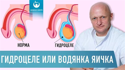  Возможные заболевания, способные вызвать увеличение объема пальцев у мужчин 