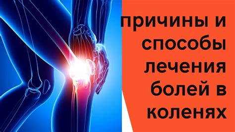  Необходимость консультации врача при появлении болей в коленях во время танцевальных тренировок 