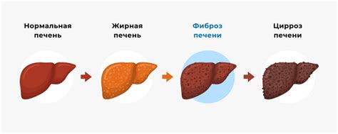 Бца с молоком и профилактика заболеваний печени