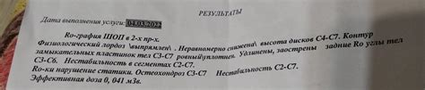 Взаимодействие комбилипена и никотиновой кислоты