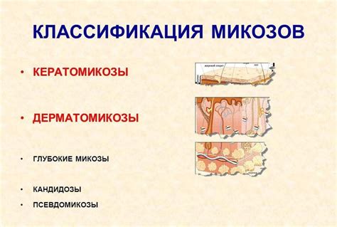 Виды грибковых заболеваний