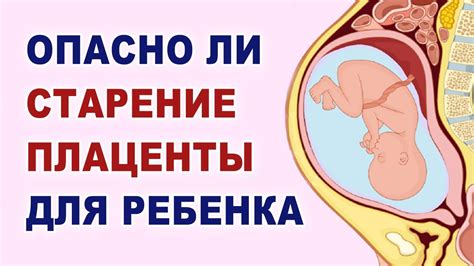 Влияние расположения плаценты на пол ребенка