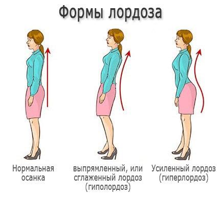 Возможность исправить лордоз оперативным путем