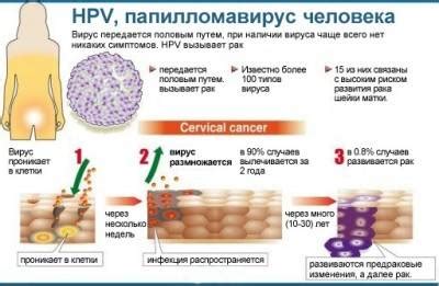 Возможные последствия заражения ВПЧ