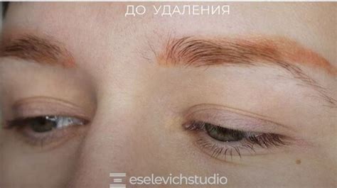 Волнующие вопросы об удалении волос восковыми полосками