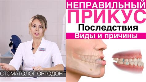 Вредные последствия неправильного наклона