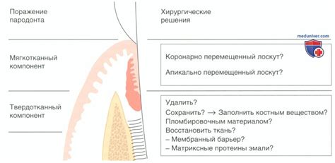 Выбор метода расправки корней