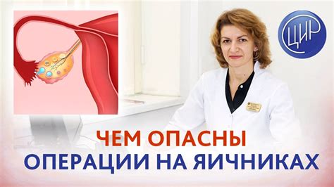 Действие Джеса на кисту яичника: механизм воздействия