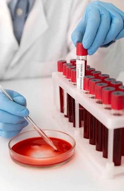 Диагностика низкого гемоглобина без анализа крови