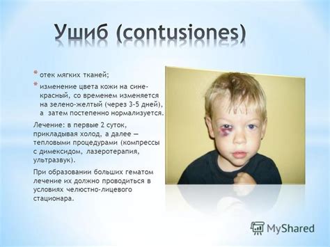 Изменение цвета экокожи со временем
