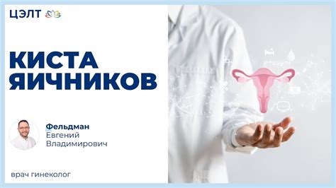 Информация о кистах яичников и спиральной контрацепции