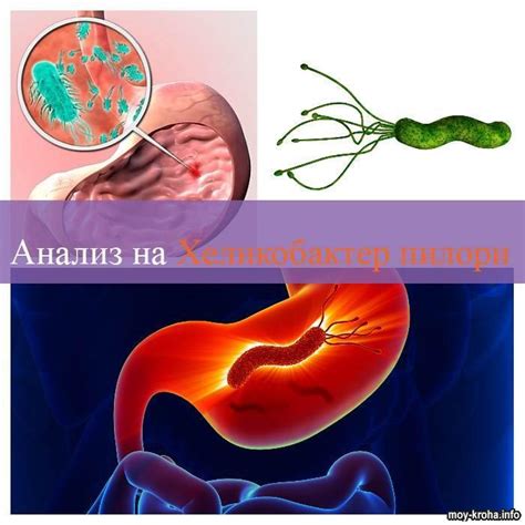 Исследование на хеликобактер пилори