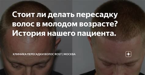 Итоги: стоит ли делать операцию пересадки волос