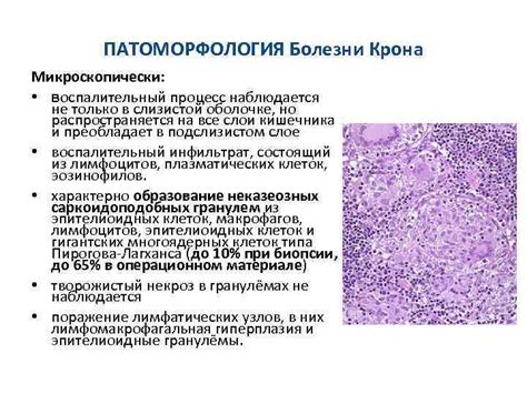 Ключевые аспекты занятий спортом при болезни Крона