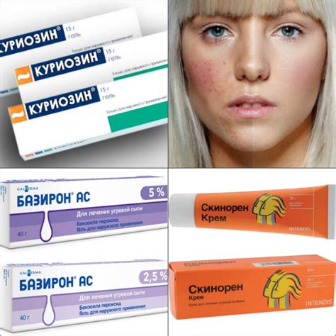 Косметика и методы маскировки прыщей в различных местах