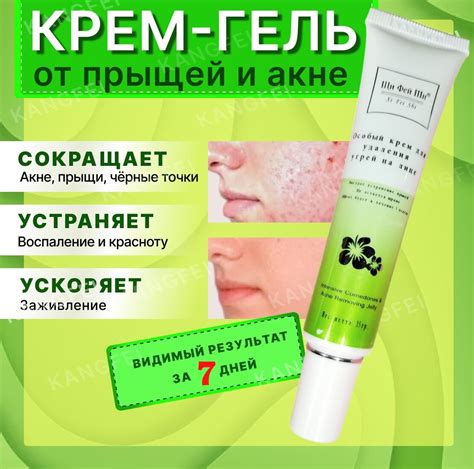 Косметические процедуры для удаления комедонов и черных точек на носу