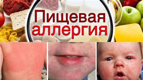 Лечение и профилактика аллергии на хурму у взрослых