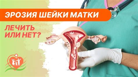 Лечение эрозии шейки у нерожавшей девушки