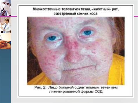 Массаж при системных заболеваниях кожи