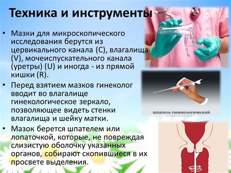 Методы лечения выделений из уретры у женщин