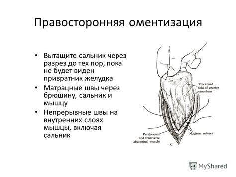 Методы лечения и оперативное вмешательство