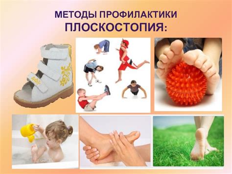 Методы профилактики плоскостопия