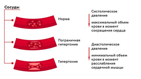 Механизм взаимодействия спазма сосудов и повышенного артериального давления