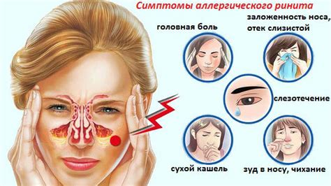 Можно ли дышать ртом, если нос заложен