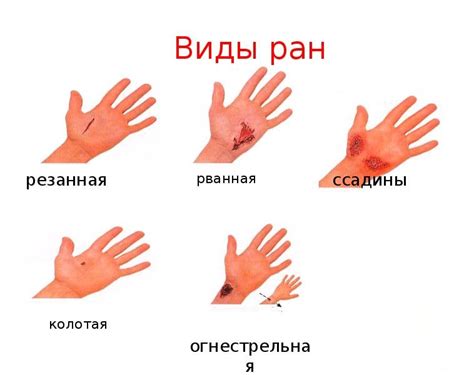 Оказываем первую помощь при повреждении кожи кошачьими когтями