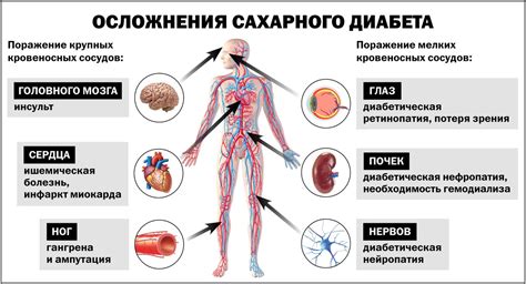 Опасность диабета 2 типа