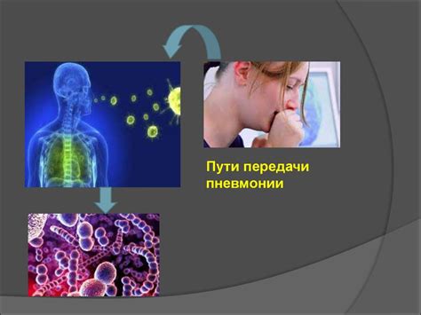 Определение пневмонии и способы передачи