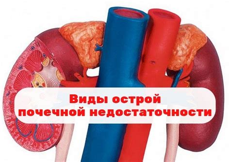 Основные причины почечной недостаточности
