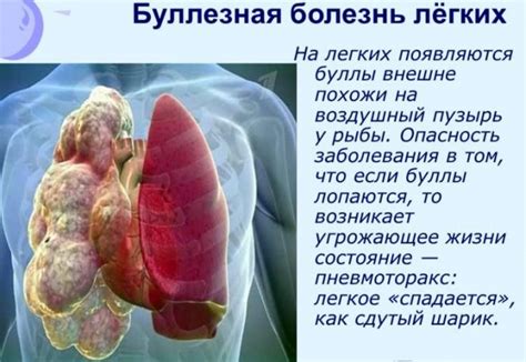 Основные симптомы боли в легких