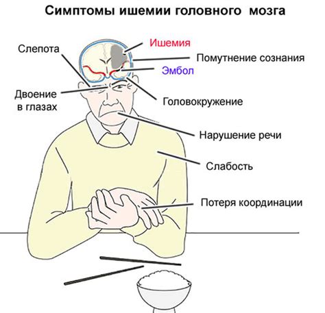 Основные симптомы ишемии в 20 лет