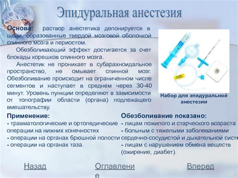 Основные этапы эпидуральной анестезии