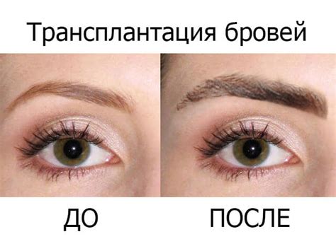 Особенности роста волос в области шрама на брови