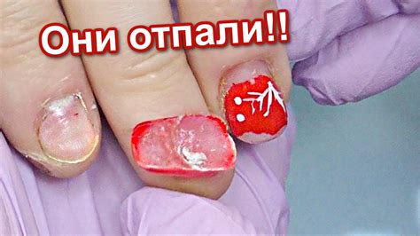 Открытый секрет: как улучшить состояние обгрызенных ногтей