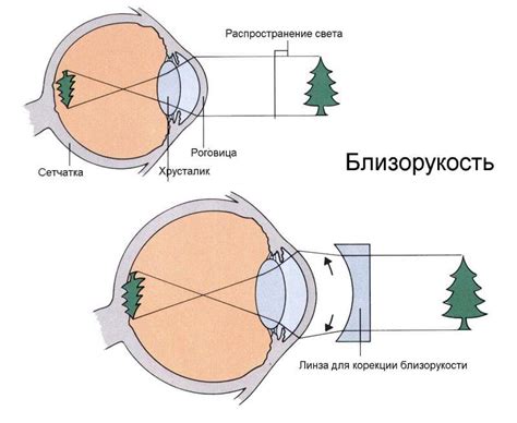 Плюсовое зрение и его особенности