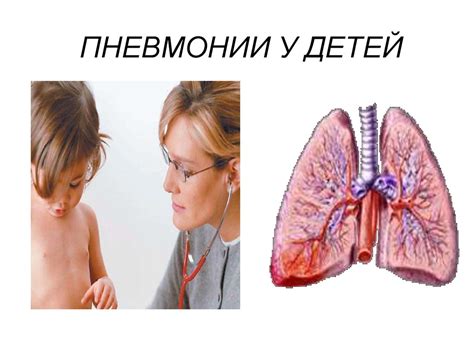 Пневмония у детей и школьников