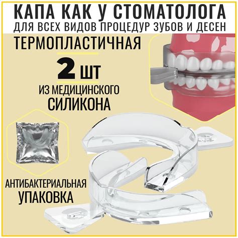 Подбор капы для верхней челюсти