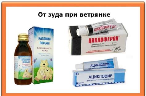 Подходящие кремы для использования при ветрянке на лице