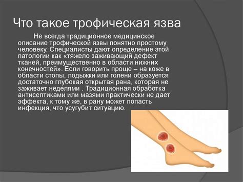 Понятие трофической язвы