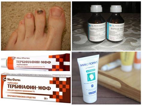 Последствия отсутствия ногтей