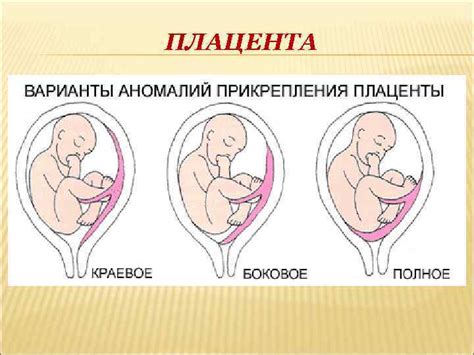 Последствия расположения плаценты