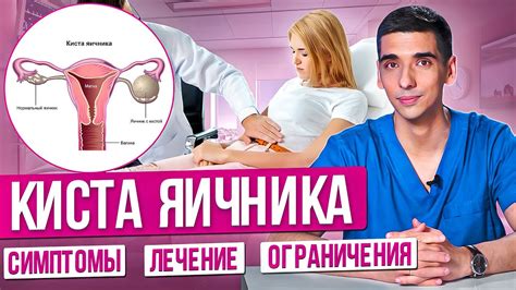 Поставка спирали при кисте яичника: важность и возможности