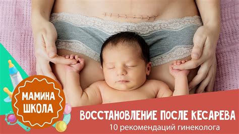 Постепенное восстановление после кесарево на 33 неделе