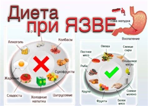 Потребление вареной свеклы при язвах желудка